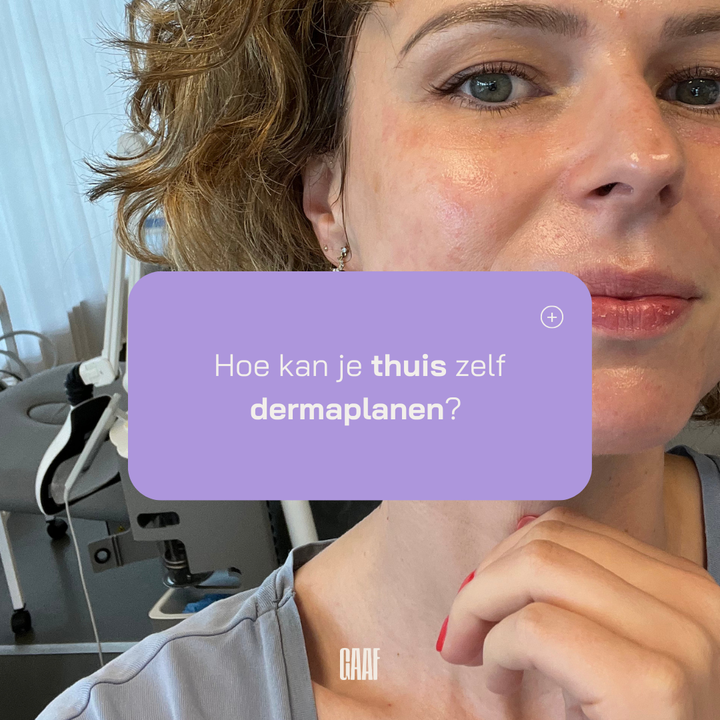 Waarom je beter stopt met zelf te dermaplanen