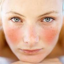 3 symptomen van een gevoelige huid die je niet mag negeren