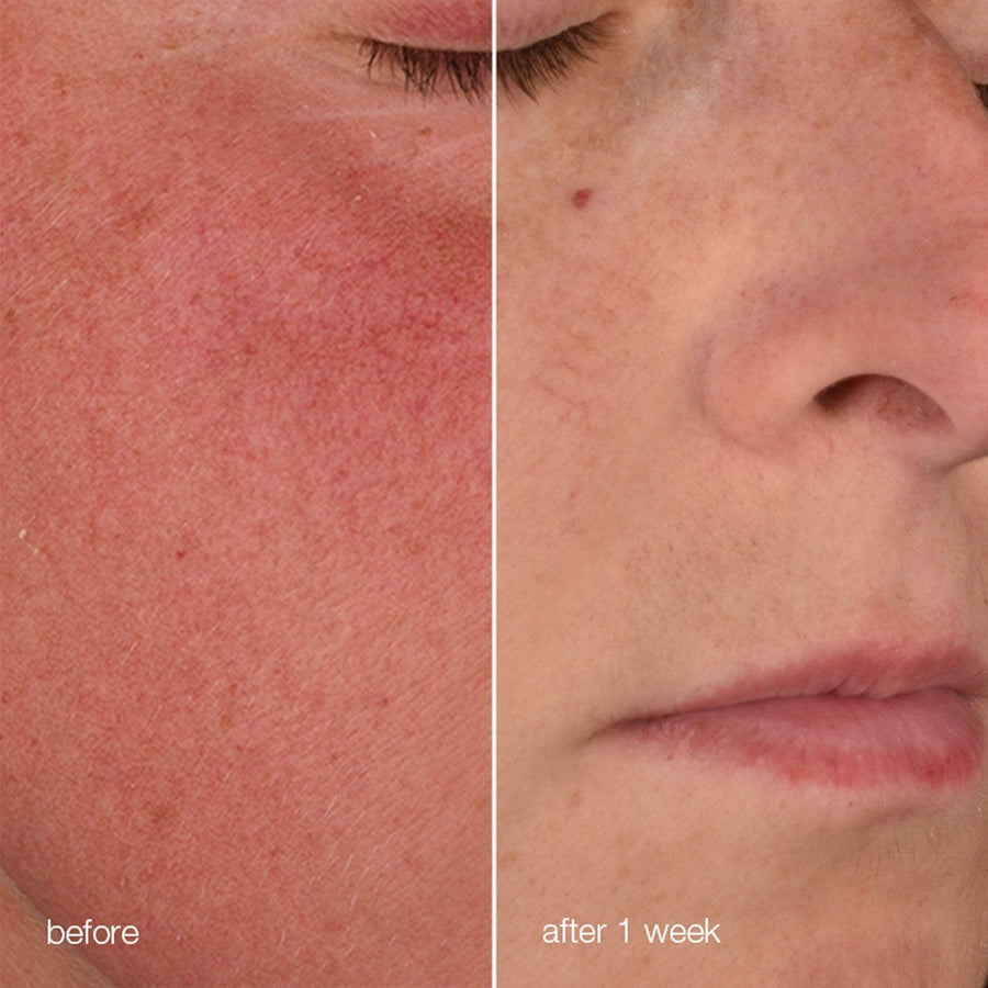 Stabilizing Repair Serum