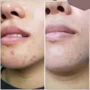 Cell Core Pro LED Mask - PRE ORDER